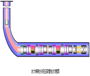 浙江5-1/2”套...
